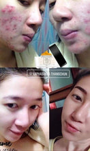 Load image into Gallery viewer, Egyptian Miracle cream for all skin issues
