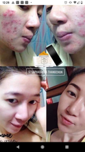 Load image into Gallery viewer, Egyptian Miracle cream for all skin issues
